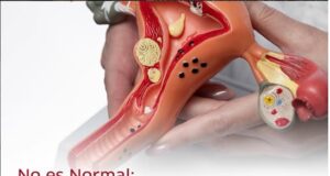 Sangrado uterino anormal afecta al 30% de las mujeres